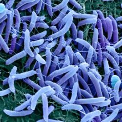 نقش میکروبیوم واژن و عفونت‌های میکروبی در بروز زایمان زودرس: بررسی علمی و مکانیسم‌های التهابی