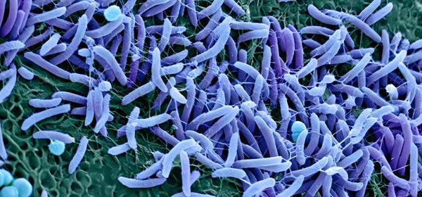 نقش میکروبیوم واژن و عفونت‌های میکروبی در بروز زایمان زودرس: بررسی علمی و مکانیسم‌های التهابی