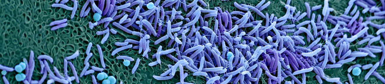 نقش میکروبیوم واژن و عفونت‌های میکروبی در بروز زایمان زودرس: بررسی علمی و مکانیسم‌های التهابی